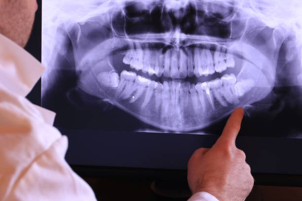 Urgent Tooth Repair in FL